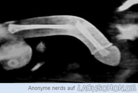 94106_penisknochen.jpg